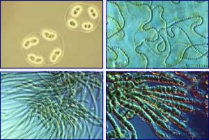 Resultado de imagen de LAS CIANOBACTÉRIAS (CIANOFITAS O ALGAS VERDE-AZULES)