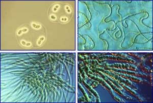 Varios tipos de cianobacterias